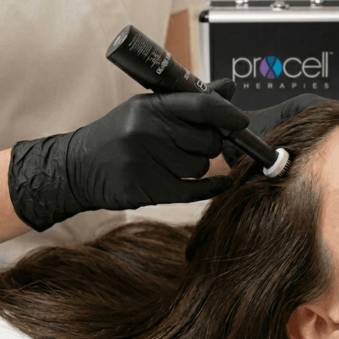 PROCELL PARA EL CABELLO X3 at STONE AESTHETICS in West columbia, SC