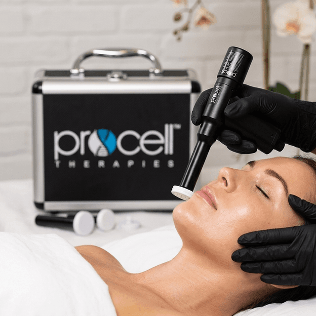 MD PROCELL MICROCHANNELING X 3 at STONE AESTHETICS in West columbia, SC