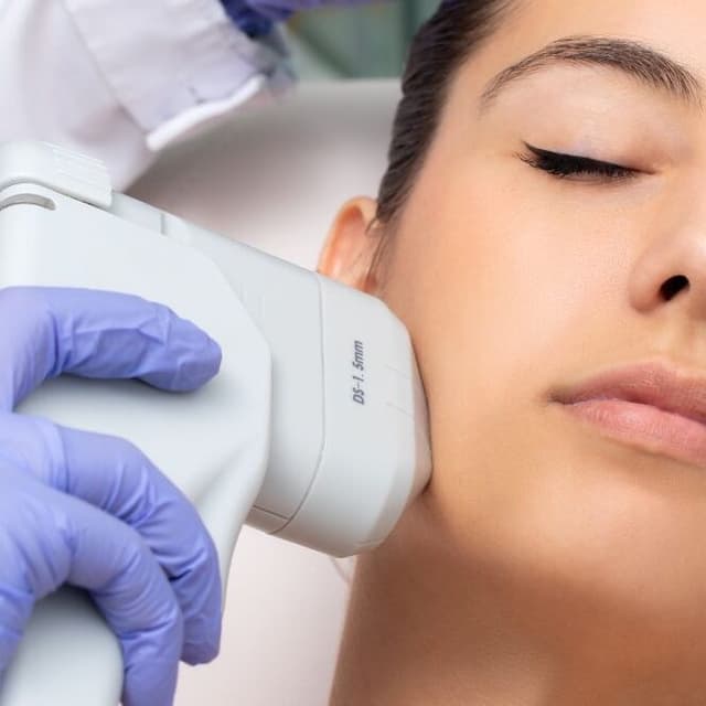 HIFU X2 at STONE AESTHETICS in West columbia, SC