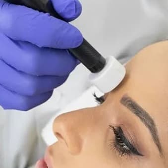 REMOCIÓN DE MICROPIGMENTACIÓN X3 at STONE AESTHETICS in West columbia, SC